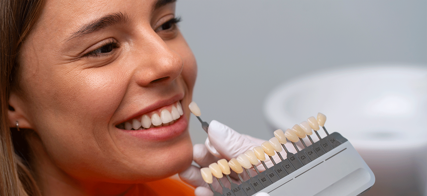 Dental Lamine Nedir?